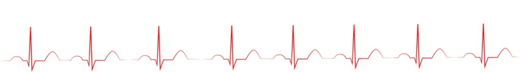 EKG mit Herz