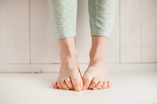 Women's tired ankles with clasped fingers and bulging veins close-up on a light background.