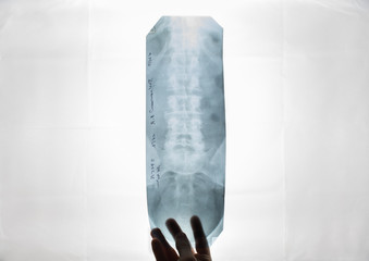 radiologist holds in his hand X-ray,