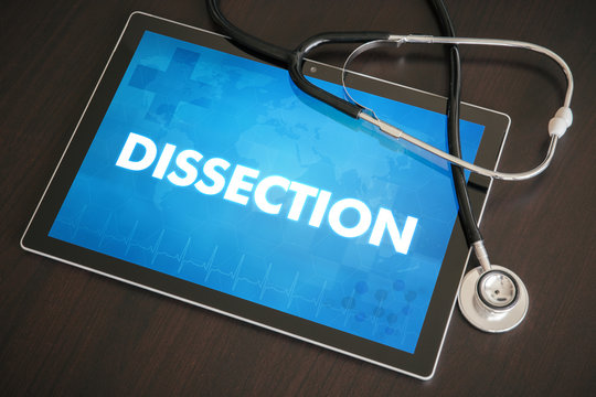 Dissection (gastrointestinal disease related) diagnosis medical concept on tablet screen with stethoscope
