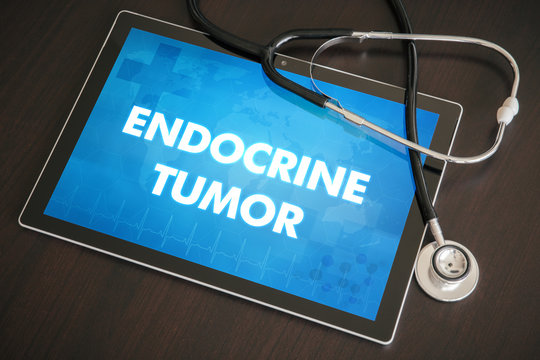 Endocrine tumor (endocrine disease) diagnosis medical concept on tablet screen with stethoscope