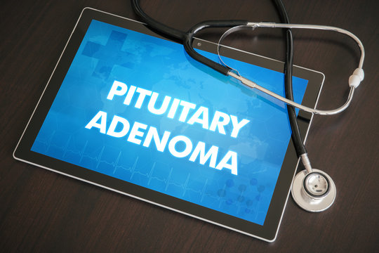 Pituitary adenoma (endocrine disease) diagnosis medical concept on tablet screen with stethoscope