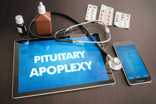 Pituitary apoplexy (endocrine disease) diagnosis medical concept on tablet screen with stethoscope