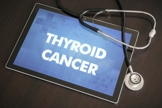 Thyroid cancer (endocrine disease) diagnosis medical concept on tablet screen with stethoscope
