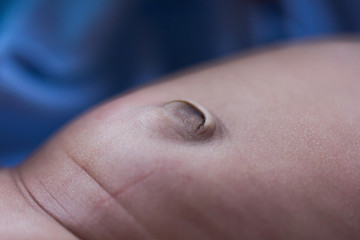 Close-up of a newborn’s belly showing the drying umbilical cord stump, representing post-birth...