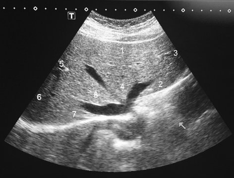 Liver Segments 