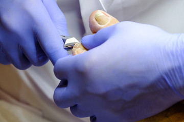 Pedicure specialist works with the patient in clinic
