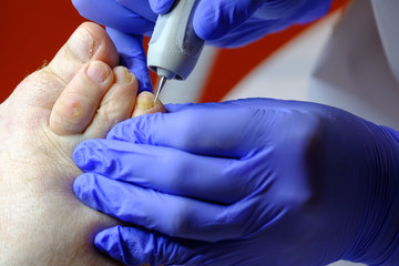 Pedicure specialist works with the patient in clinic