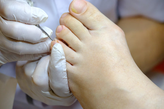Pedicure specialist works with the patient in clinic
