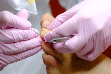 Pedicure specialist works with the patient in clinic