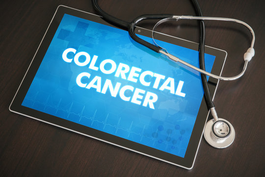 Colorectal cancer (gastrointestinal disease) diagnosis medical concept on tablet screen with stethoscope