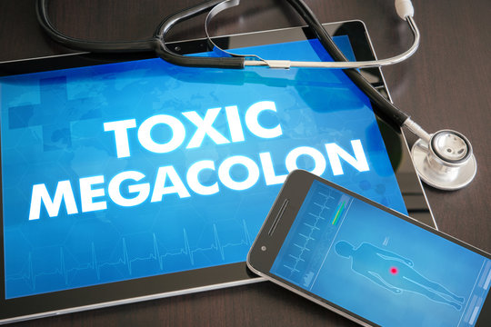Toxic megacolon (gastrointestinal disease) diagnosis medical concept on tablet screen with stethoscope