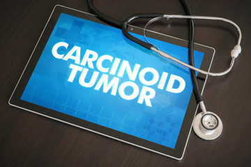 Carcinoid tumor (cancer related) diagnosis medical concept on tablet screen with stethoscope
