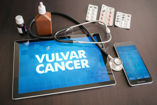 Vulvar cancer (cancer type) diagnosis medical concept on tablet screen with stethoscope