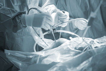 Fototapeta na wymiar Knee surgery hospital operation