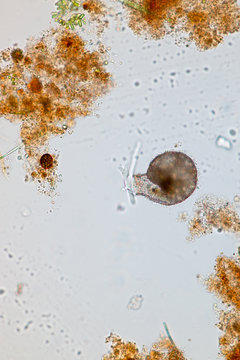 Difflugia in a droplet under microscopic view.
