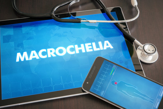 Macrochelia (cutaneous disease) diagnosis medical concept on tablet screen with stethoscope
