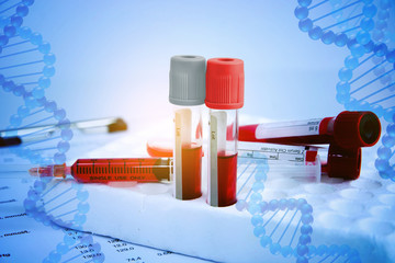 DNA testing of the blood in the laboratory with blood sample collection tubes and syringe. (blue tone)