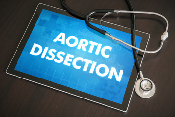 Aortic dissection (heart disorder) diagnosis medical concept on tablet screen with stethoscope