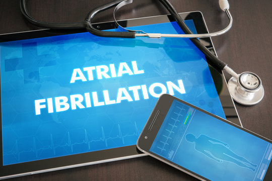 Atrial fibrillation (heart disorder) diagnosis medical concept on tablet screen with stethoscope