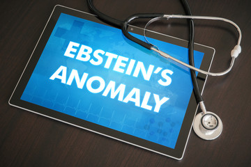 Ebstein's anomaly (heart disorder) diagnosis medical concept on tablet screen with stethoscope