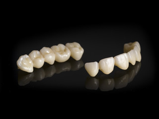 Monolithic zirconia restorations full arch implant supported with the ceramic load in vestibular, back background