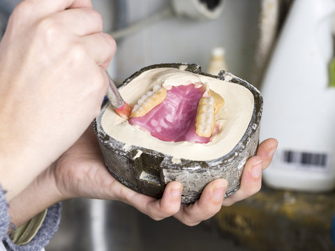 Dental technician is working with a dental flask of a complete upper on cast