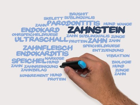 Zahnstein