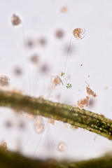 Vorticella (organism) in waste water under the microscope.