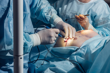 Surgeon operating live shot
