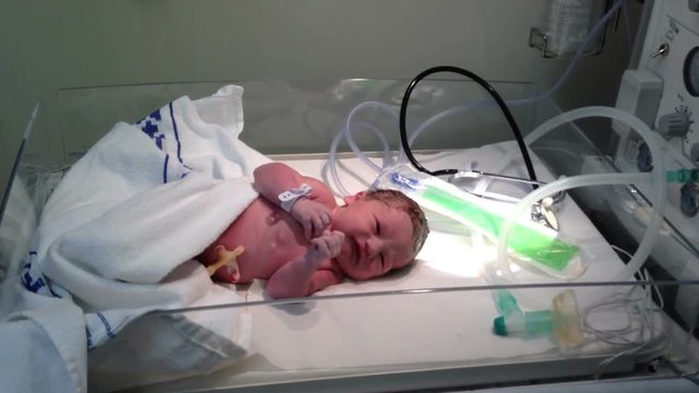 Newborn baby girl a few minutes old being weighed by a hospital machine