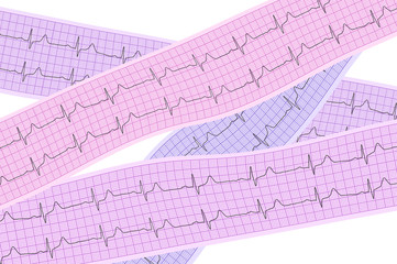 Heart analysis, electrocardiogram graph (ECG)