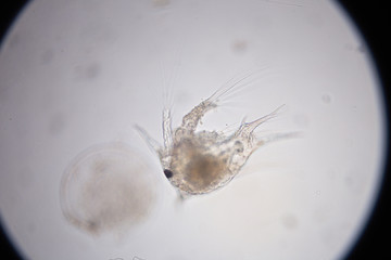 Copepod (zooplankton) in freshwater and Marine under microscope.