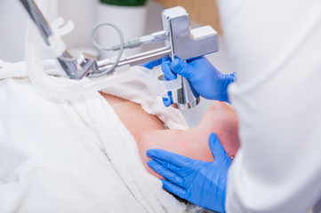 Close up process of laser peeling. Laser rejuvenation and skin treatment of problematic skin in the...