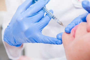 Close up Hands of cosmetologist making injection in face, lips. Woman gets beauty facial injections...