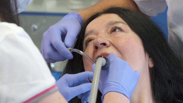 Female dentist polishing client's lower teeth. Close up of dental hygienist using prophy cup at her work. Assistant using suction to pump out patient's saliva