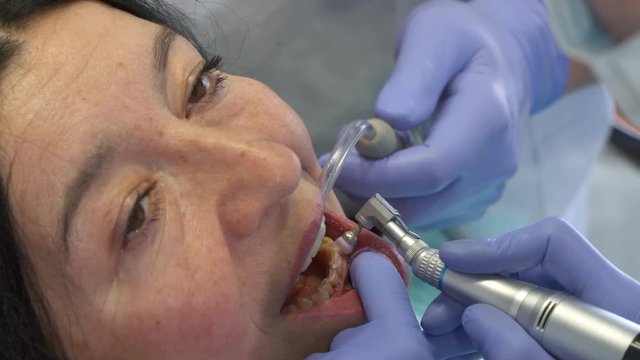 Professional dentist changing the brush of prophy cup. Close up of dental hygienist cleaning client's teeth from plaque. Assistant holding suction in woman's mouth