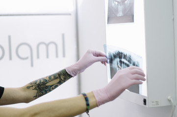 Female doctor dentist looking at x-ray
