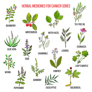 Best herbal remedies for canker sores
