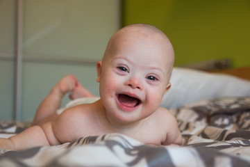Portrait of cute baby boy with Down syndrome © dtatiana