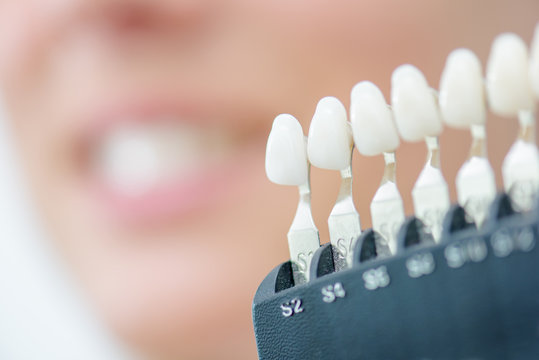 display of artificial teeth