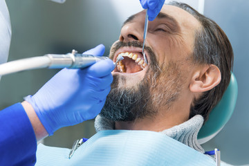 Fototapeta premium Dentist cleans teeth. Patient with opened mouth.
