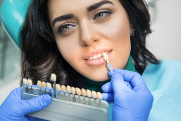 Dentist holding tooth color chart. Face of a young female.