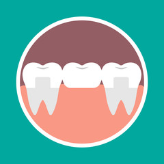 Vector illustration icon dental bridge. Orthodontics, dental implants, orthopedics.