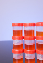 Pile of urine sample tube