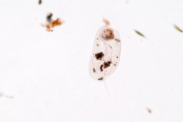 Ostracods or ostracodes are a class of the Crustacea (class Ostracoda), under the microscopic view.