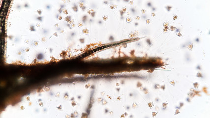 Vorticella (organism) in waste water under the microscope.
