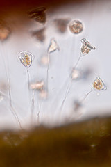 Vorticella (organism) in waste water under the microscope.