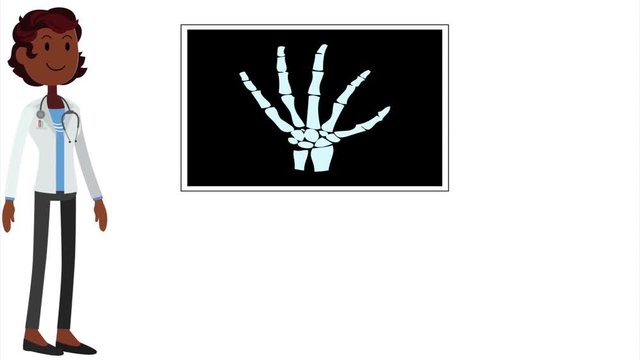 femme medecin radiographie de la main