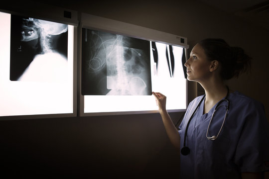 Doctor looking at x-ray image